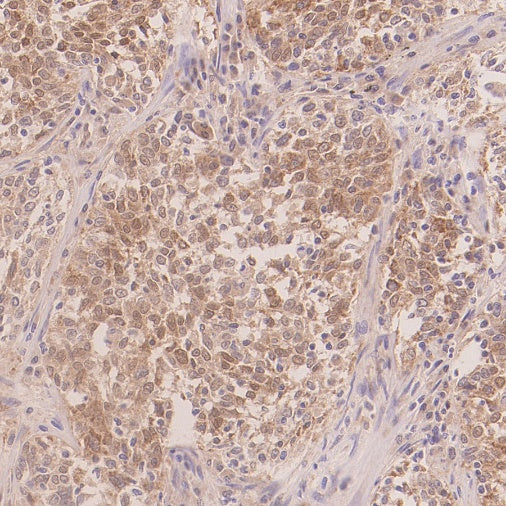 IRGQ Recombinant Rabbit mAb (S-2648-17)