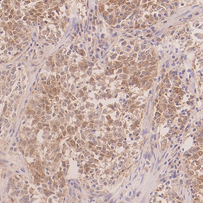 IRGQ Recombinant Rabbit mAb (S-2648-17)