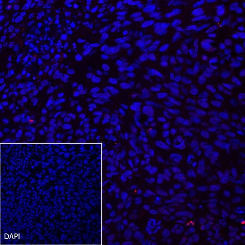 CA125 Recombinant Rabbit mAb (Alexa Fluor® 555 Conjugate) (SDT-555-41)