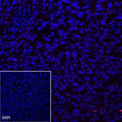 CA125 Recombinant Rabbit mAb (Alexa Fluor® 555 Conjugate) (SDT-555-41)