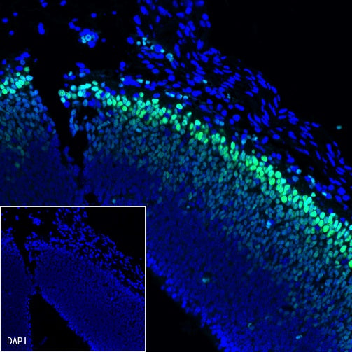 TBR1 Recombinant Rabbit mAb (S-1102-34)
