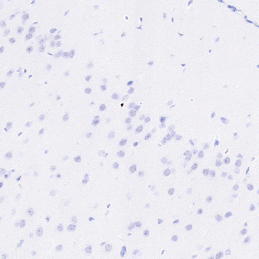 Neutrophil Elastase Recombinant Rabbit mAb (S-4397-22)