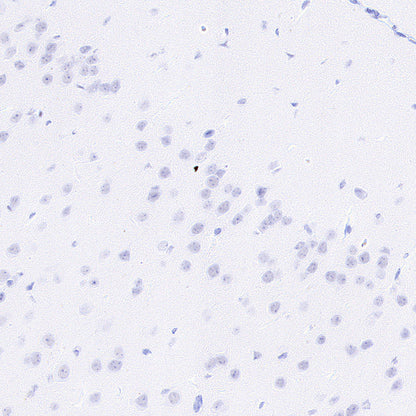 Neutrophil Elastase Recombinant Rabbit mAb (S-4397-22)