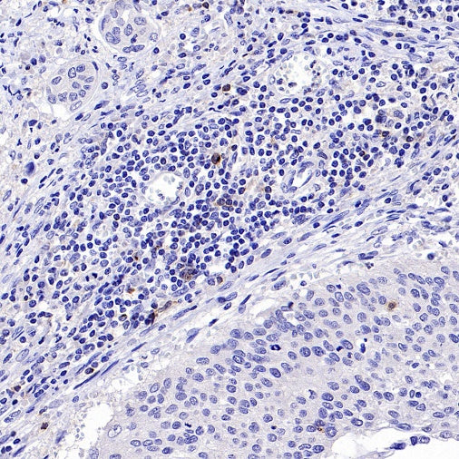CD70 Recombinant Rabbit mAb (S-1725-277)