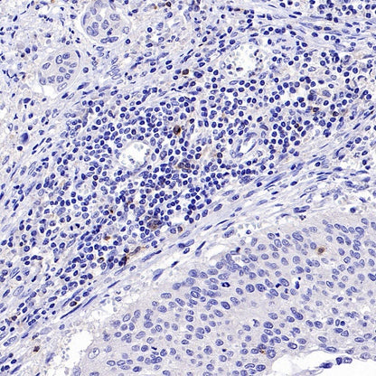 CD70 Recombinant Rabbit mAb (S-1725-277)