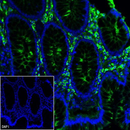 Human IgA1 Recombinant Rabbit mAb (S-2513-50)