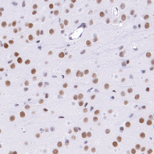 KDM1/LSD1 Recombinant Rabbit mAb (S-1280-80)