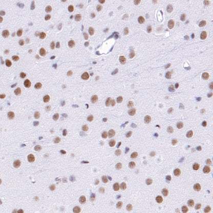 KDM1/LSD1 Recombinant Rabbit mAb (S-1280-80)