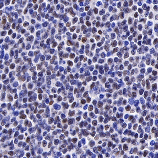 Cyclin D1 Recombinant Rabbit mAb (SDT-R423)