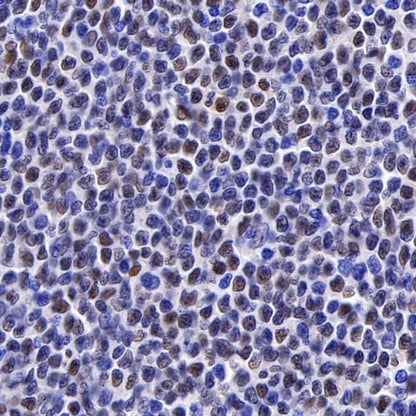 Cyclin D1 Recombinant Rabbit mAb (SDT-R423)