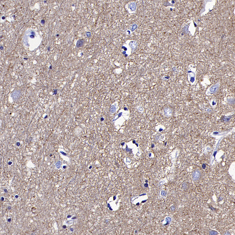 ATP1B1 Rabbit Polyclonal Antibody