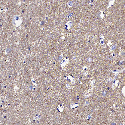 ATP1B1 Rabbit Polyclonal Antibody