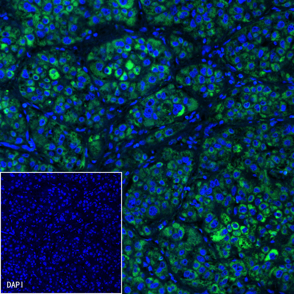 SDHB Recombinant Rabbit mAb (SDT-1162-2)