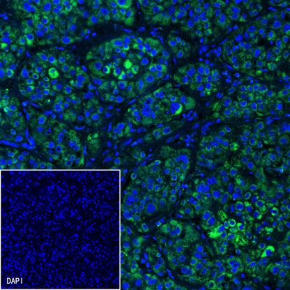 SDHB Recombinant Rabbit mAb (SDT-1162-2)