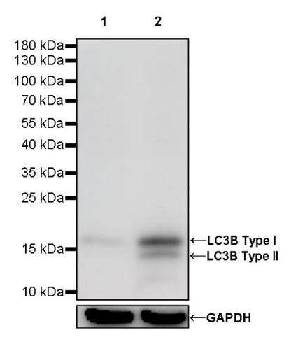 LC3B Recombinant Rabbit mAb (S-477-89)