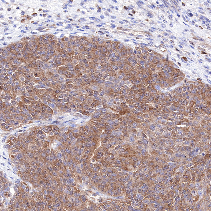 MEK1 Recombinant Rabbit mAb (SDT-308-32)
