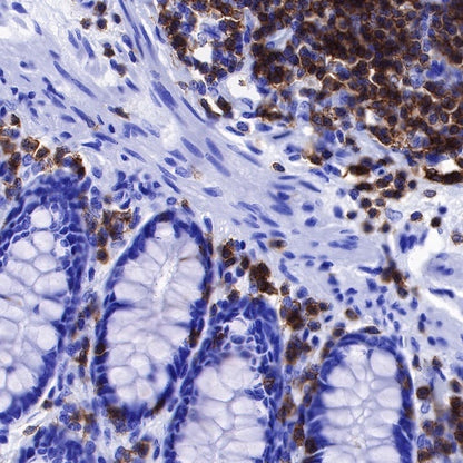 Lck Recombinant Rabbit mAb (SDT-316-15)