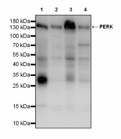 PERK Recombinant Rabbit mAb (S-2822-52)