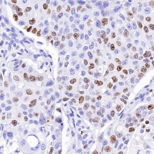 Ki67 Mouse mAb (SDT-606-33)
