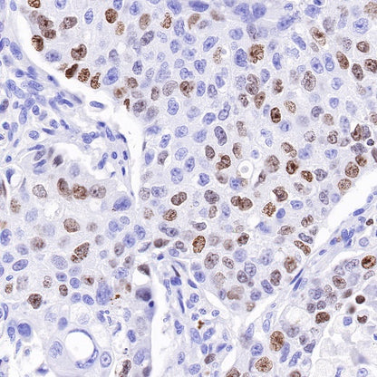 Ki67 Mouse mAb (SDT-606-33)