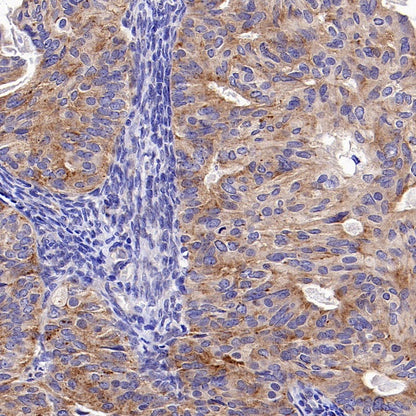 PSEN2 Recombinant Rabbit mAb (S-2084-14)