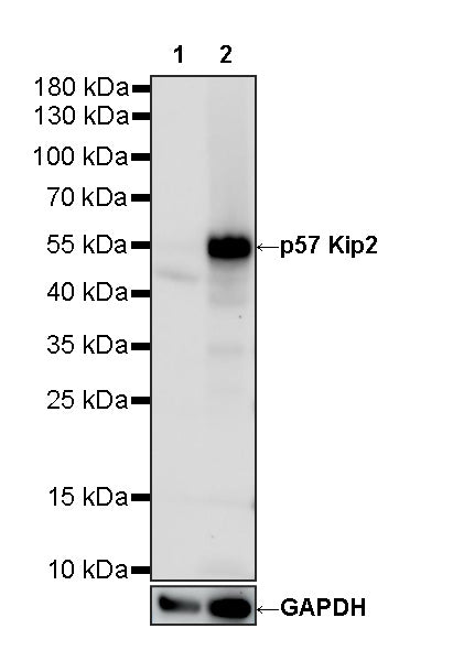 p57 Kip2 Recombinant Rabbit mAb (S-6119)