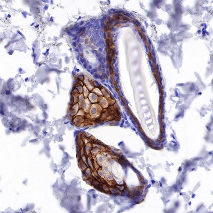 TACSTD2/TROP2 Recombinant Rabbit mAb (S-R237)
