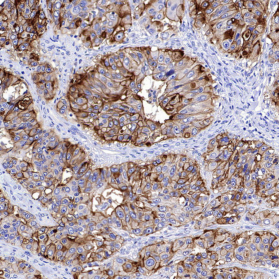 FOLR1 Recombinant Rabbit mAb (SDT-3635-124)