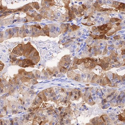 ALDH3A1 Recombinant Rabbit mAb (S-R220)