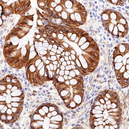 COX2 Recombinant Rabbit mAb (SDT-380-259)