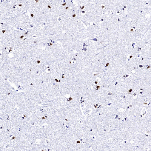 MeCP2 Recombinant Rabbit mAb (S-1884-28)