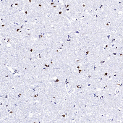 MeCP2 Recombinant Rabbit mAb (S-1884-28)