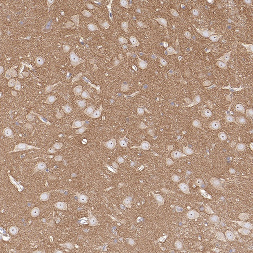 Src Recombinant Rabbit mAb (S-1181-16)