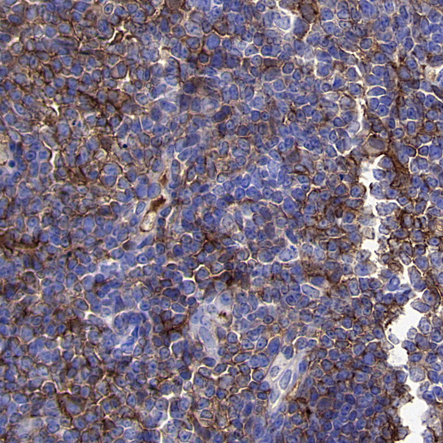 PD-L1 Recombinant Rabbit mAb (S-5311)