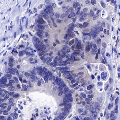 SMAD4 Recombinant Rabbit mAb (SDT-168-62)