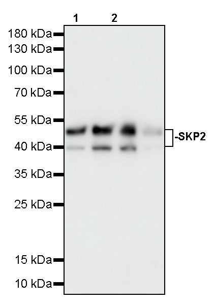 SKP2 Recombinant Rabbit mAb