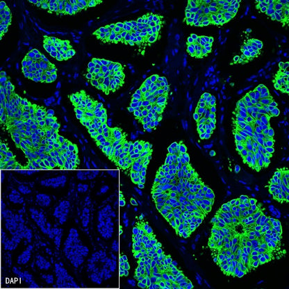 Cytokeratin 19 fragment (CY211) Recombinant Rabbit mAb (Alexa Fluor® 488 Conjugate) (SDT-197-28)