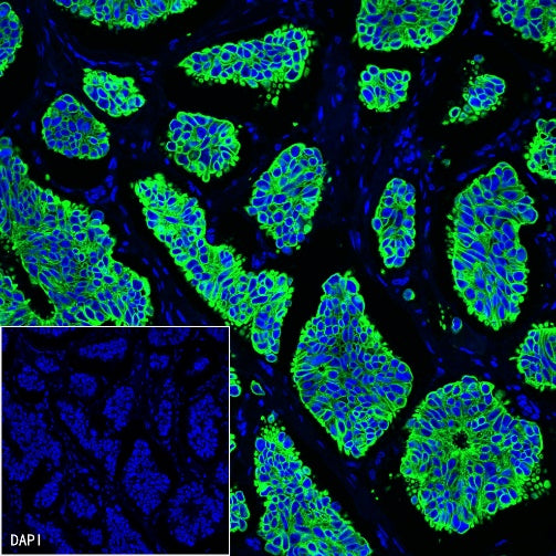 Cytokeratin 19 fragment (CY211) Recombinant Rabbit mAb (Alexa Fluor® 488 Conjugate) (SDT-197-28)