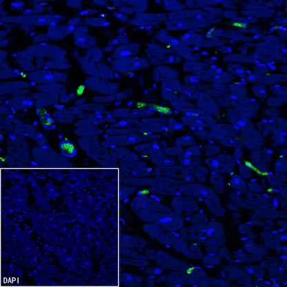 CD61 Recombinant Rabbit mAb (S-2515-6)