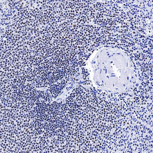 AiolosI/KZF3 Recombinant Rabbit mAb (S-1268-42)
