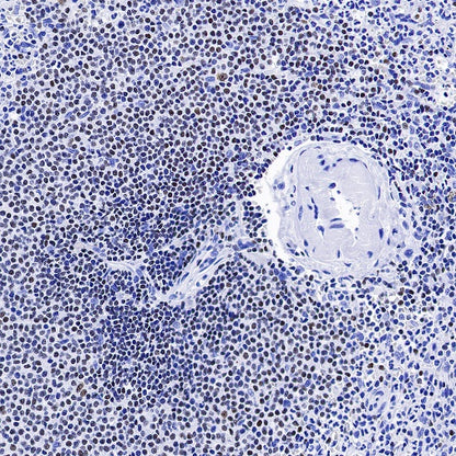 AiolosI/KZF3 Recombinant Rabbit mAb (S-1268-42)