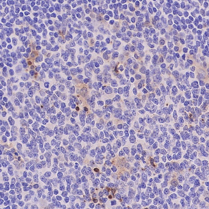 Cleaved Caspase-3 (Asp175) Recombinant Rabbit mAb (S-1406-409)