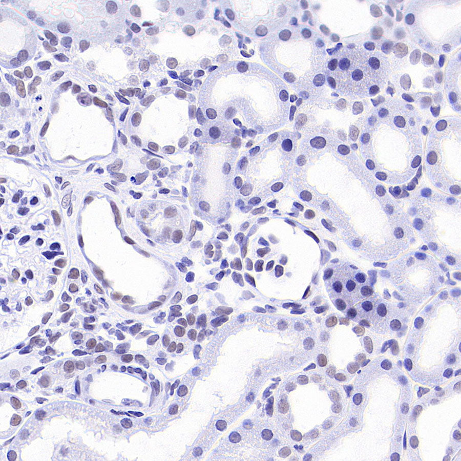 INI-1/SMARCB1 Recombinant Rabbit mAb (S-4068-21)