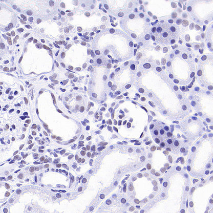 INI-1/SMARCB1 Recombinant Rabbit mAb (S-4068-21)