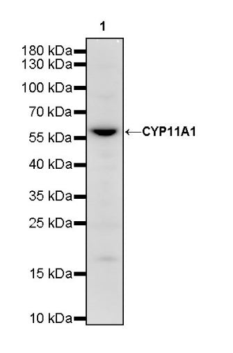 CYP11A1 Rabbit Polyclonal Antibody