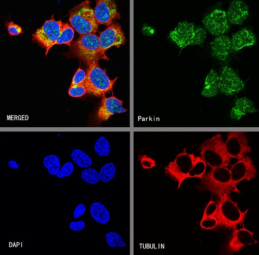 Parkin Rabbit Polyclonal Antibody