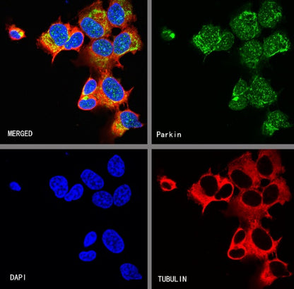 Parkin Rabbit Polyclonal Antibody