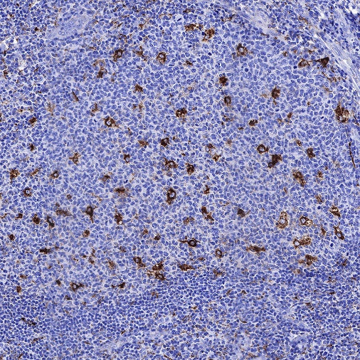 Cathepsin D Recombinant Rabbit mAb (S-R345)