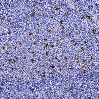 Cathepsin D Recombinant Rabbit mAb (S-R345)