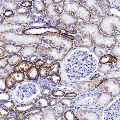 NaK-ATPase Recombinant Rabbit mAb (S-1373-39)